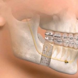 Oral-Maxillofacial-Surgery